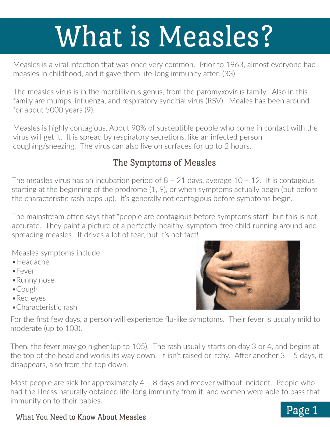 what you-need-to-know-about-measles-109940